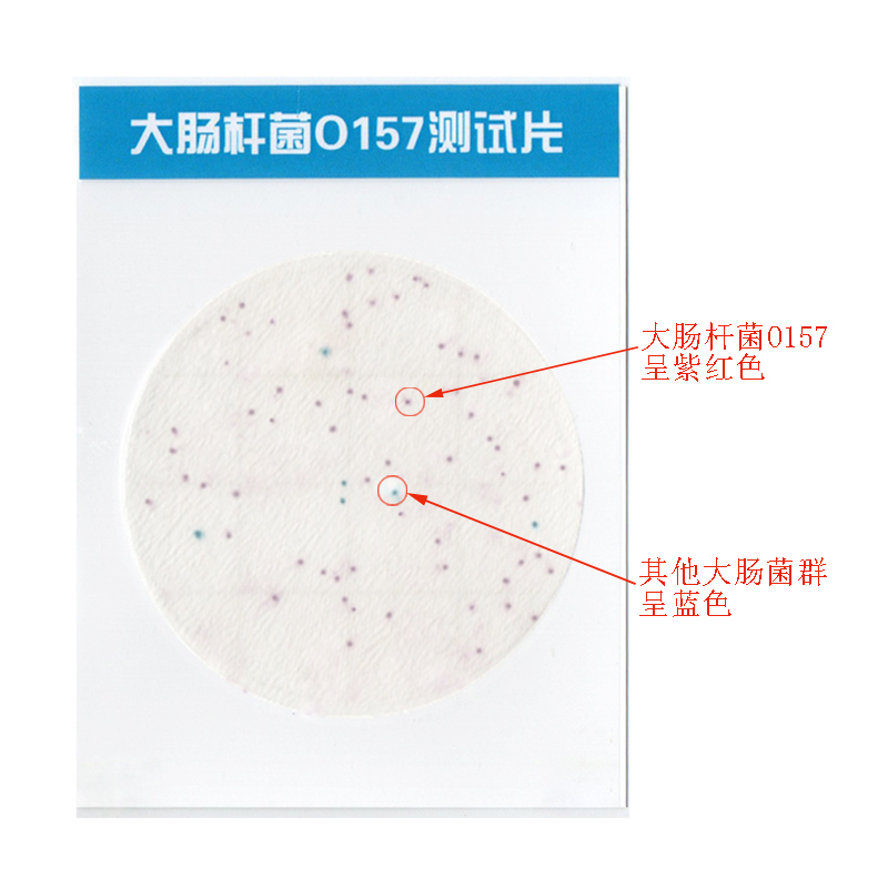 O157陽(yáng)性.jpg